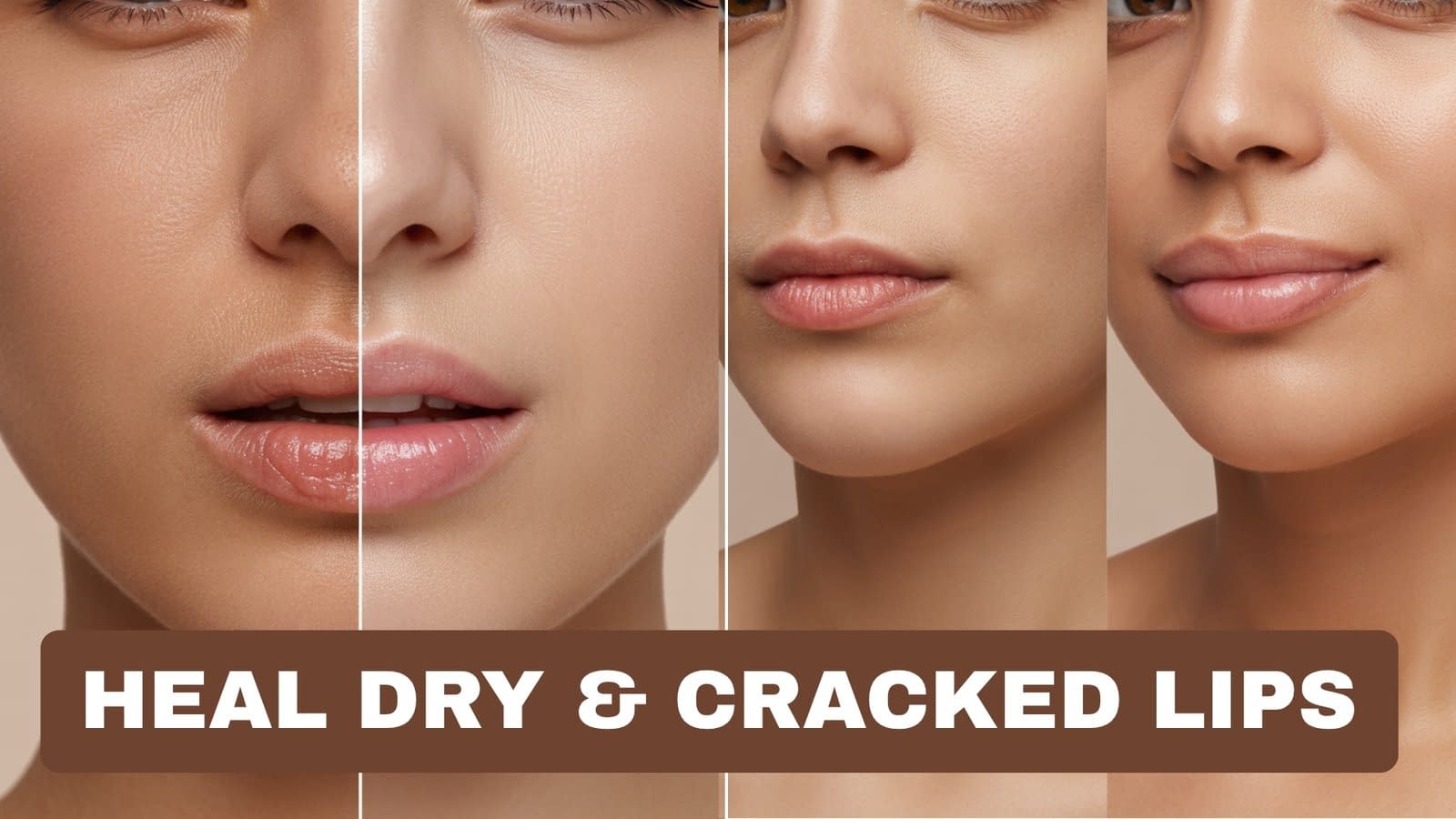 How to Heal Dry, Cracked Lips Naturally: Proven Remedies