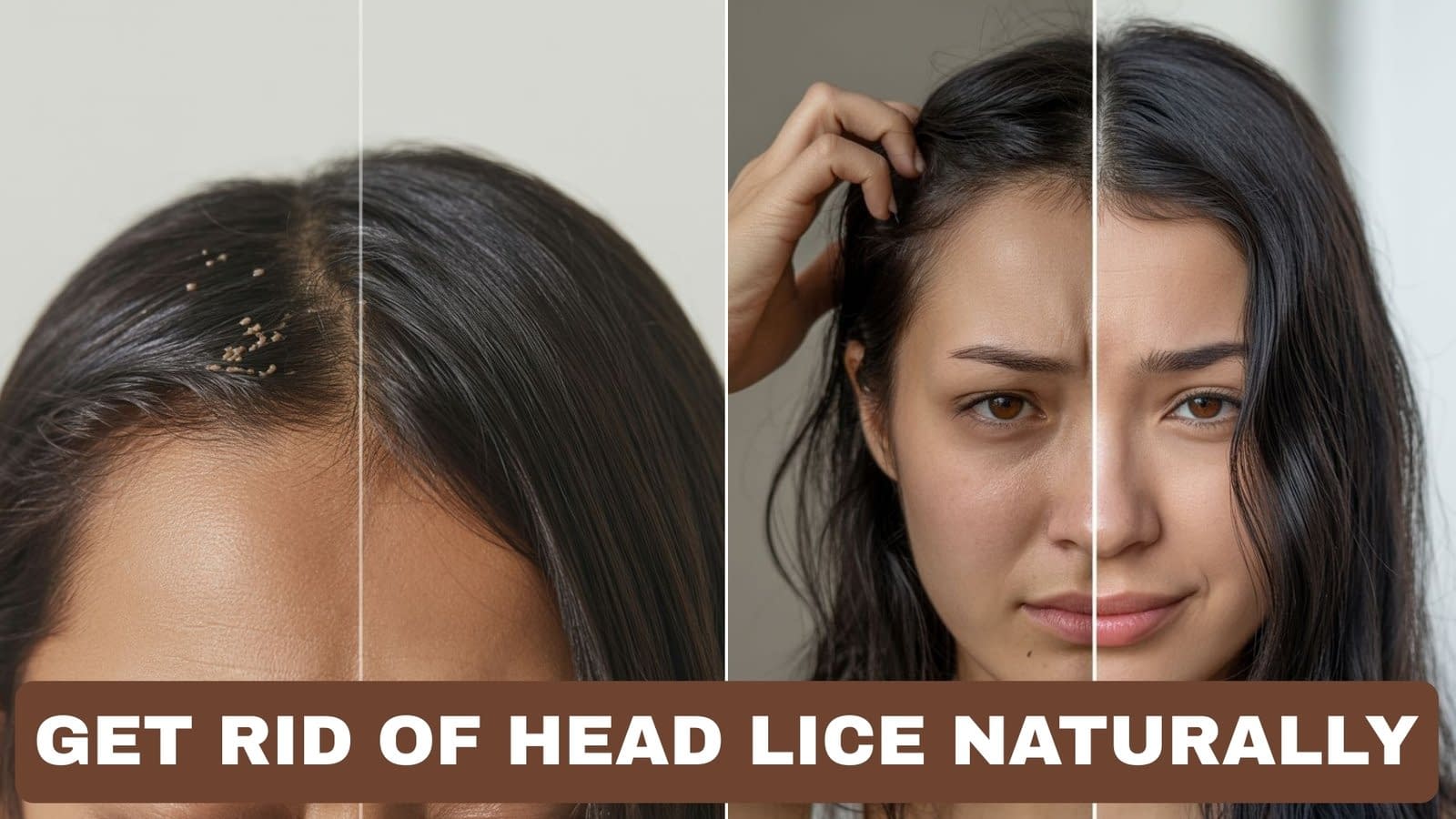 How to Get Rid of Head Lice Naturally at Home Fast and Safely